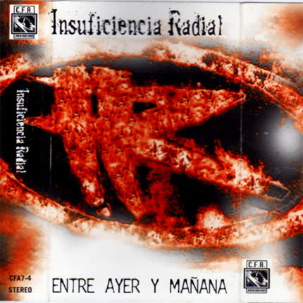 INSUFICIENCIA RADIAL: Entre ayer y mañana